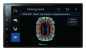 Preview: Pioneer SPH-DA77DAB 1-DIN / 2-DIN Autoradio mit WiFi android auto apple carplay Touchmonitor DAB+ SPHDA77DAB
